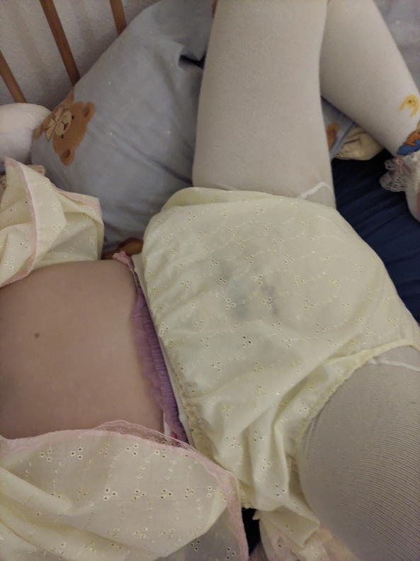 moooore Pictures :D, Sissybaby,Adultbaby,AB/DL,ABDL,AB,SB,Diaper,Abdl, Adult Babies,Sissy Fashion