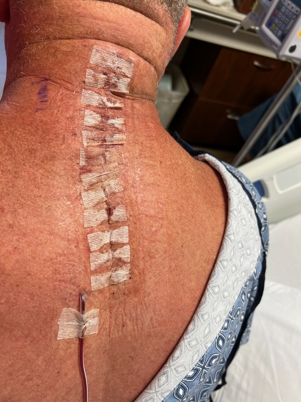 Accident update - Been away for many months was hit from behind ive missed being in my little dresses.at a traffic light and broke my back., Sissy Baby,Diapers,curly sissy hair, Fairytale,Dolled Up
